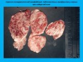 Серозно-геморрагический лимфаденит подчелюстных лимфоузлов у свиньи при сибирской язве