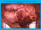 Острая фибринозно-некротизирующая бронхопневмония у быка при пастереллезе