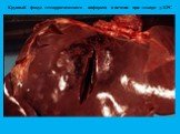 Крупный фокус геморрагического инфаркта в печени при эмкаре у КРС