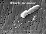 Klebsiella pneumoniae. http://ru.wikipedia.org/wiki/%D0%A4%D0%B0%D0%B9%D0%BB:Klebsiella-pneumoniae.jpg