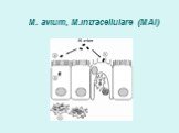 M. avium, M.intracellulare (MAI)