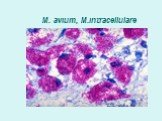 M. avium, M.intracellulare