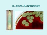 Нетуберкулезные микобактерии Слайд: 20