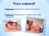 Типы асфиксий. Первичная (возникает в момент рождения); Вторичная (развивается в первые сутки жизни младенца).