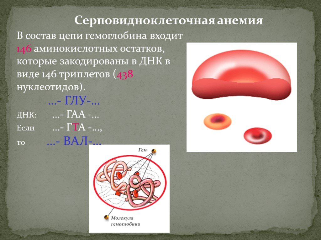 Ген серповидноклеточной анемии. Серповидно клетосная анемия. Серпоаидно клеточная анемия. Серповидно клеточный гемоглобин. Серповидна клеточная Амения.