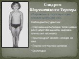 Синдром Шерешевского-Тернера. 45 хромосом – отсутствует одна половая хромосома (Х0). Наблюдается у девочек Нарушение пропорций тела (низкий рост, укороченные ноги, широкие плечи, шея короткая) Крыловидная кожная складка на шее Пороки внутренних органов Бесплодие