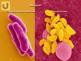 Бактерии Туберкулезная палочка Токсоплазма