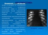 Милиарный туберкулез легких отличается от экзогенного аллергического альвеолита отсутствием связи с внешними антигенами, более выраженной тяжестью и длительностью течения заболевания, особенностью рентгенологических проявлений, положительными серологическими и кожными реакциями с туберкулезным антиг