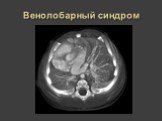 Рентгеновская диагностика пороков развития лёгких у детей Слайд: 33