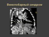 Рентгеновская диагностика пороков развития лёгких у детей Слайд: 35