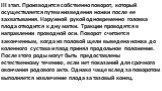 III этап. Производится собственно поворот, который осуществляется путем низведения ножки после ее захватывания. Наружной рукой одновременно головка плода отводится к дну матки. Тракции проводятся в направлении проводной оси. Поворот считается законченным, когда из половой щели выведена ножка до коле