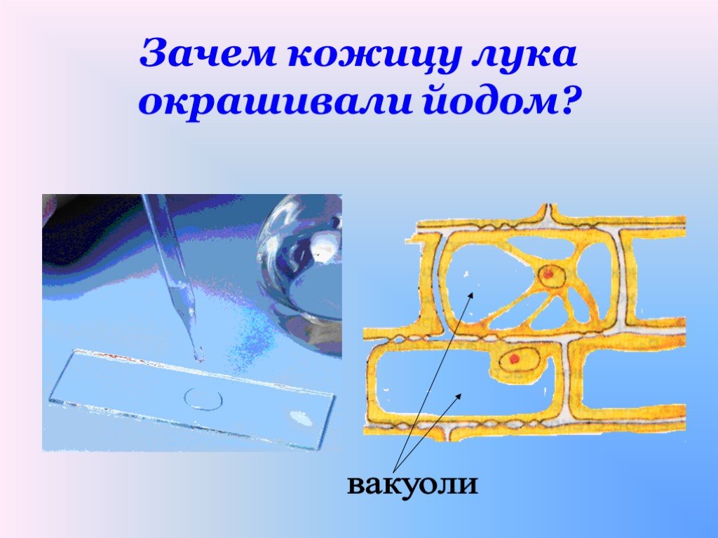 Лук под микроскопом 5 класс лабораторная. Клетки кожицы чешуи лука под микроскопом. Клетки кожицы лука окрашенные йодом. Клетки кожицы лука под микроскопом с йодом. Кожица лука под микроскопом с йодом.