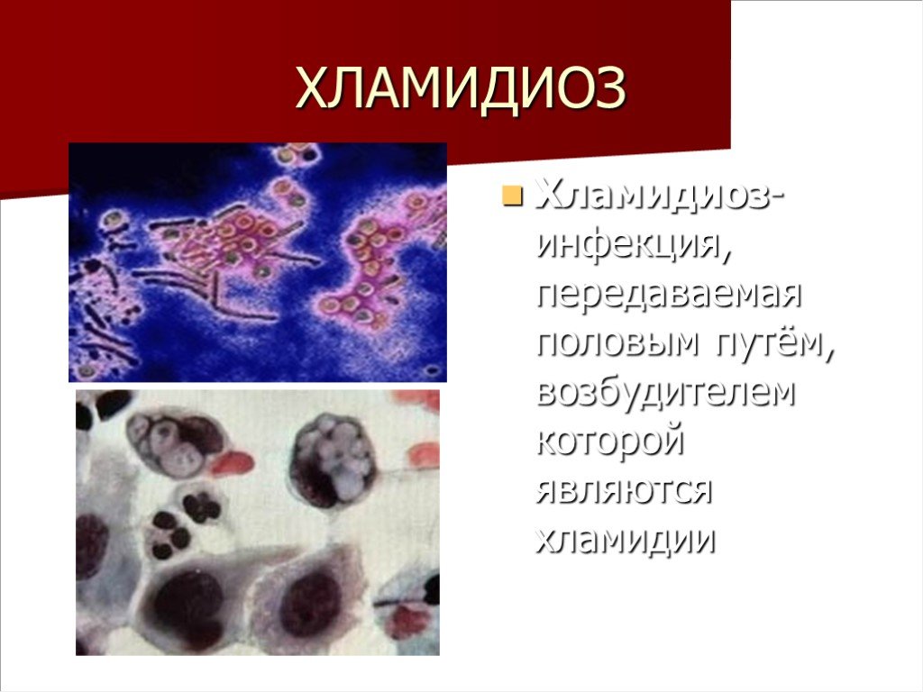 Хламидия chlamydia. Урогенитальный хламидиоз Дерматовенерология.
