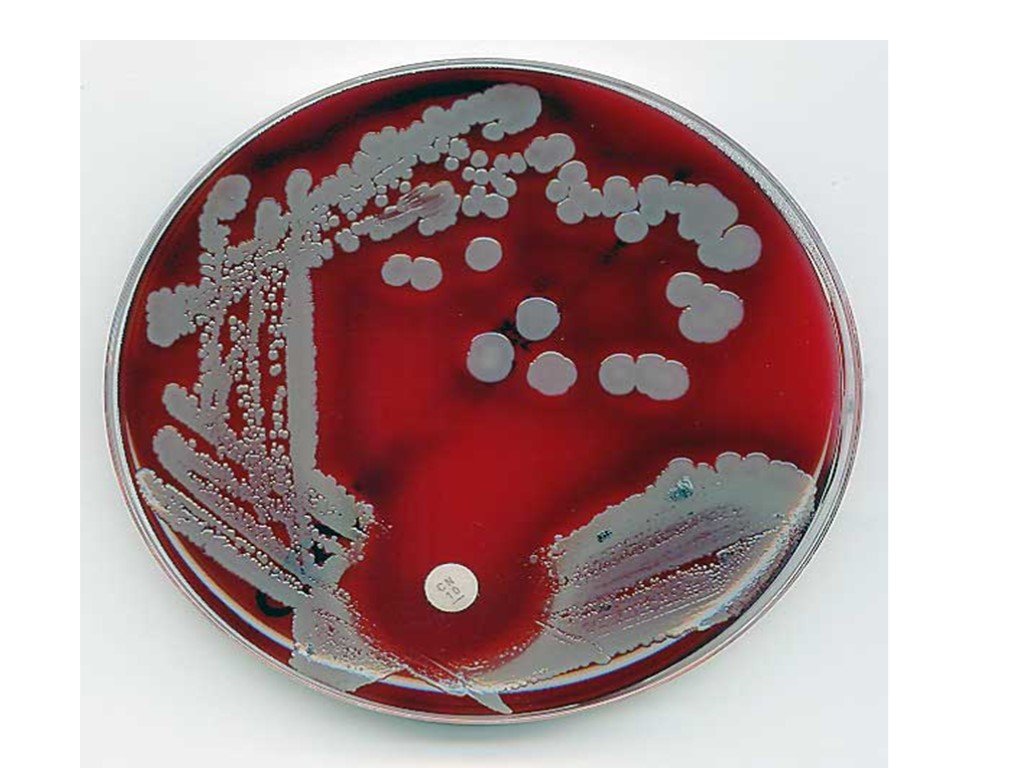 1 staphylococcus aureus. Стафилококк в чашке Петри. Гонококки в чашке Петри. Менингококк на чашке Петри. Стафилококк ауреус микробиология.