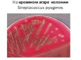 На кровяном агаре колонии Streptococcus pyogenes