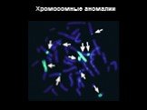 Хромосомные аномалии