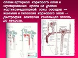 спазм артериол коркового слоя и шунтирование крови на уровне кортикомедулярной зоны сосудов → ишемия и гипоксия коркового слоя → дистрофия эпителия канальцев вплоть до некроза.