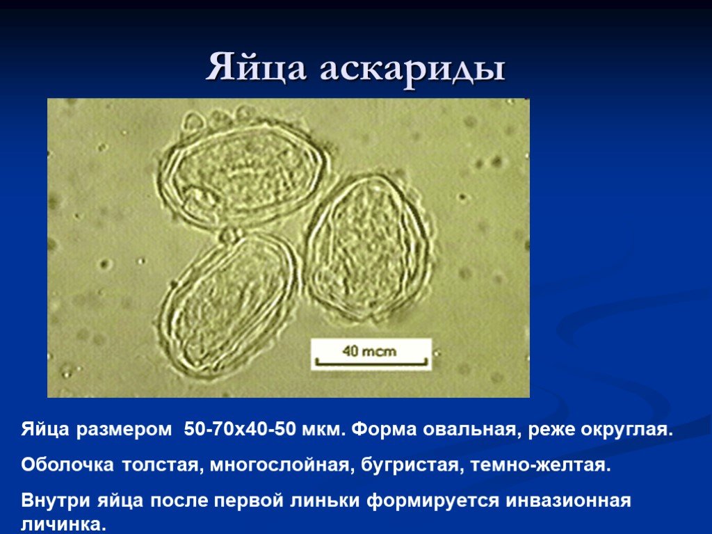 Аскарида размер. Размер яйца аскариды человеческой. Яйца аскариды под микроскопом. Неоплодотворенное яйцо аскариды без белковой оболочки. Яйца аскарид бугристая оболочка.