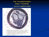 Тип Nemathelminthes Класс Nematoda Ascaris lumbricoides