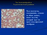 Тело изогнутое, сплющенное, сужено на обоих концах, имеет жгутик, который идет по краю ундулирующей мембраны. Тип Sarcomastigophora Trypanosoma brucei gambiense