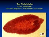 Тип Plathelminthes Класс Trematoda Fasciola hepatica – печеночный сосальщик