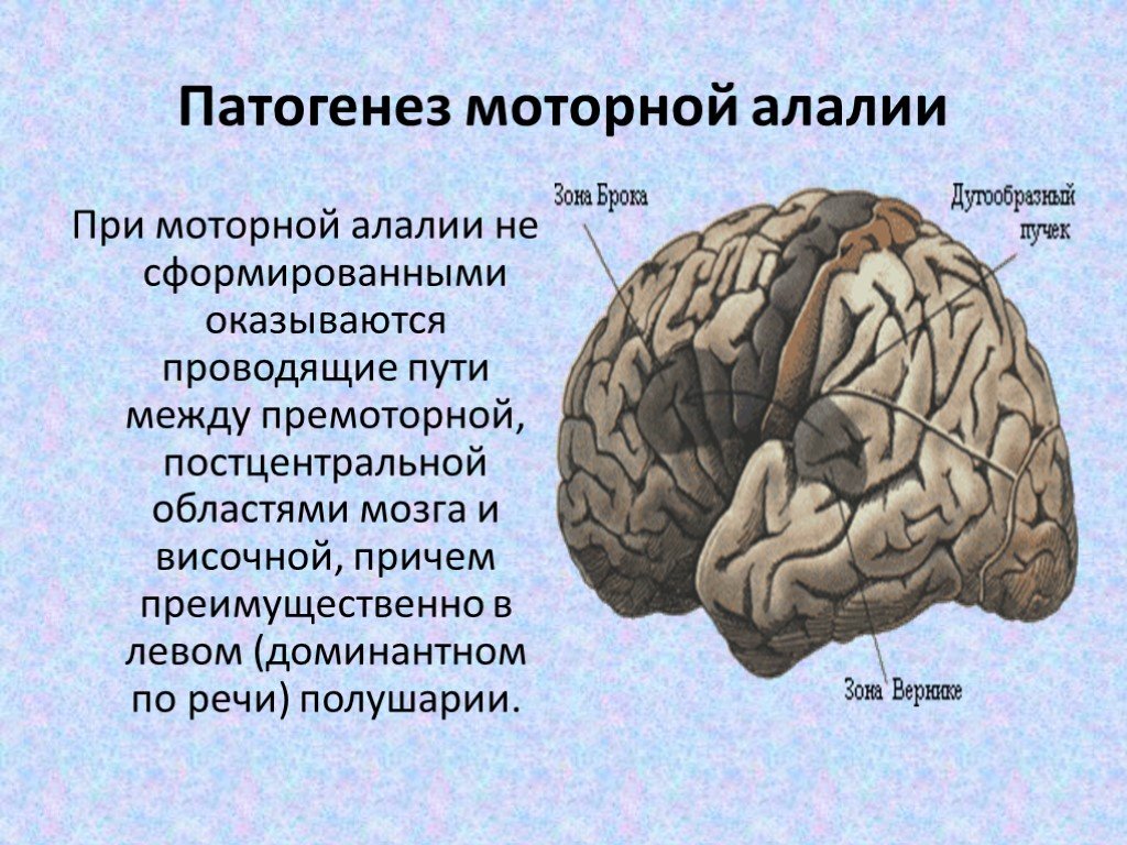 Особенности головного мозга ребенка. Алалия Вернике Брока. Мозговые механизмы сенсорной алалии. Сенсорная алалия зона Вернике. Мозговой механизм нарушения при моторной алалии.