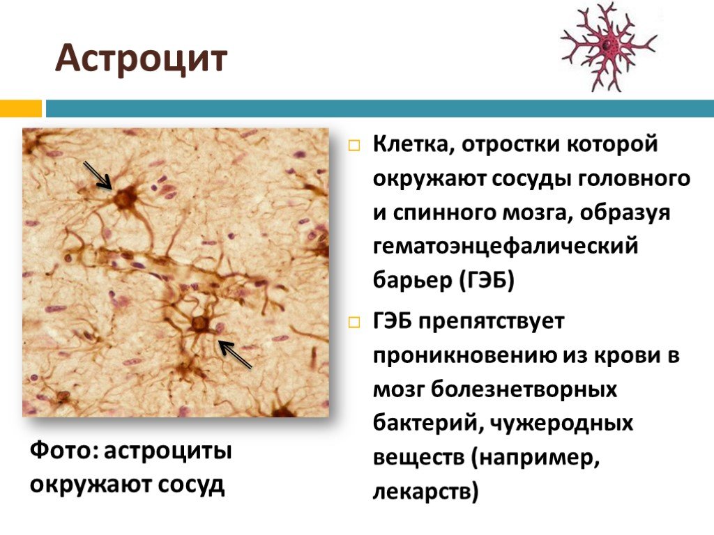 Астроциты мозга. Астроциты спинного мозга. Астроциты головного мозга. Нейроглия в спинном мозге. Клетки головного мозга астроциты.
