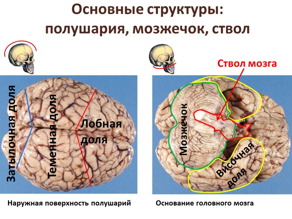 Гемисферы мозжечка изменение. Опухоли полушарий мозжечка. Левая гемисфера мозжечка. Доли полушарий мозжечка. Правая гемисфера мозжечка.