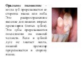Оральное положение – когда зуб прорезывается со стороны языка или неба. Это распространенное явление для нижних вторых премоляров (пятых зубов). Эти зубы прорезываются последними на нижней челюсти. Если в зубной дуге не хватает места, нижний премоляр прорезывается в сторону языка.