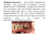 Инфраположение – когда зубы выдвинуты больше, чем соседние (слишком сильно прорезались). Например, на верхней челюсти это случается при отсутствии нижнего зуба (зубов). Верхний зуб в этом случае будет прорезываться до тех пор, пока не встретит сопротивление на своем пути (при отсутствии нижнего зуба