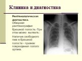Рентгенологическая диагностика. Обзорная рентгенография брюшной полости. При этом можно выявить : Наличие свободного газа в брюшной полости - признак повреждения полого органа.