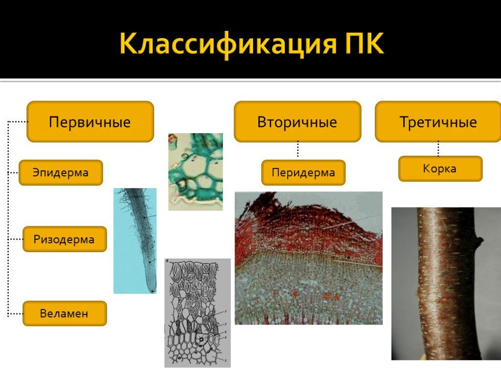 Первичные ткани. Эпидерма перидерма ризодерма. Эпидерма ризодерма перидерма корка. Ризодерма и эпидерма. Покровная ткань эпидерма ризодерма перидерма.