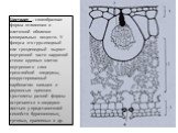 Цистолит – своеобразная форма отложения в клеточной оболочке минеральных веществ. У фикуса это грушевидный или гроздевидный вырост внутренней части наружной стенки крупных клеток внутреннего слоя трехслойной эпидермы, инкрустированный карбонатом кальция и двуокисью кремния. Цистолиты разной формы вс