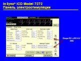 Опция RV и RV+LV ЭКС. InSync® ICD Model 7272 Панель электростимуляции