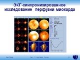 ЭКГ-синхронизированное исследование перфузии миокарда