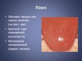 Язык. Обложен белым или серым налетом (гастрит, рак) Красный (при повышенной кислотности) Малиновый, лакированный (цирроз печени)