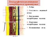 Топографическая анатомия межрёберного промежутка. 1. Ребро 2. Сосудисто - нервный пучок 3. Внутренняя межрёберная мышца 4. Наружная межрёберная мышца 5. Пункционная игла. 3 5