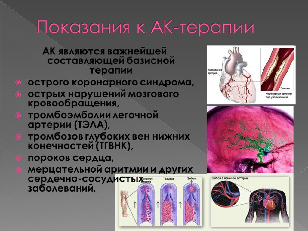 Тромбоз коронарных артерий. Тромбоэмболия артерии. Тромбоэмболия коронарной артерии. Тромбоэмболии коронарного сосуда. Тромбоэмболия легочной артерии нижних конечностей.