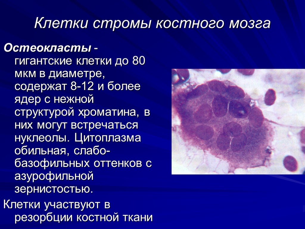 Клетки костного мозга. Ретикулярная Строма красного костного мозга. Стромальная клетка костного мозга. Стромальные клеточные элементы костного мозга. Строма в клетке.