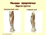 Мышечная система человека Слайд: 51