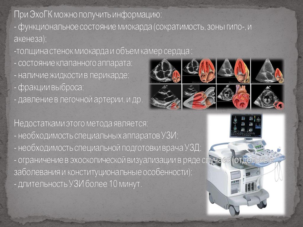 Эхо можно. Методики исследования клапанного аппарата. Методы исследования состояния клапанного аппарата. Методики исследования клапанного аппарата сердца. Методы оценки клапанного аппарата.