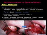 Вестибулопластика по Эдлану—Мейхеру Этапы операции: 1. Инфильтрационная анестезия,разрез слизистой оболочки параллельно изгибу челюсти(скальпелем), отступив от сли-зисто-десневой границы на 10-12 мм на участке от клыка до клыка и на 7-10 мм в области премоляров и моляров. 2.Отслаивание ножницами сли