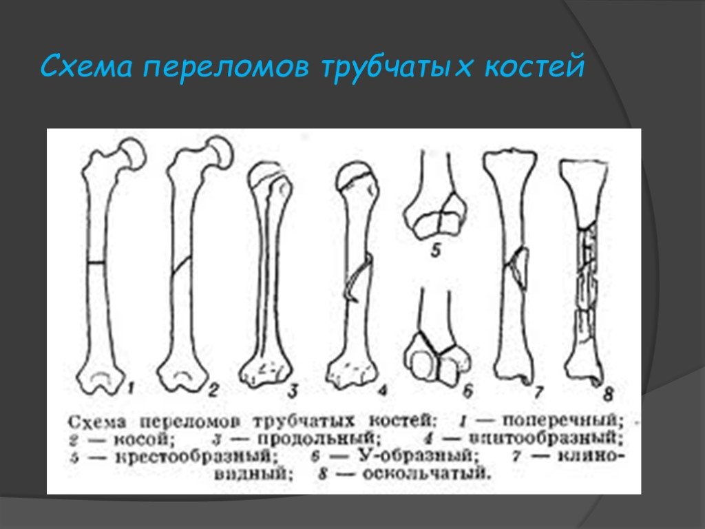 Признаки трубчатых костей