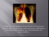 Сигаретный дым содержит более 400 различных ядовитых веществ. Все они могут стать причиной многих заболеваний, около 40 веществ вызывают рак, 12 способствуют его возникновению.