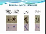 Основные клетки нейроглии