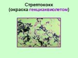 Стрептококк (окраска генцианвиолетом)
