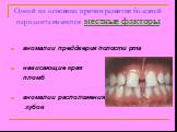 аномалии преддверия полости рта нависающие края пломб аномалии расположения зубов