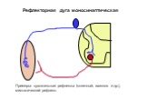 Рефлекторная дуга моносинаптическая. Примеры: сухожильные рефлексы (коленный, ахиллов и др.), миотатический рефлекс.