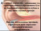 Буллезный мирингит – заболевание уха, характеризующееся образованием булл на барабанной перепонке и глубоко в наружном слуховом проходе. Буллы заполнены кровью, серозным или серозно-геморрагическим отделяемым.