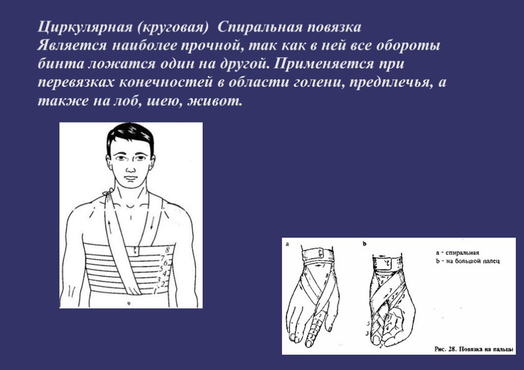 Правила наложения повязок презентация обж 7 класс